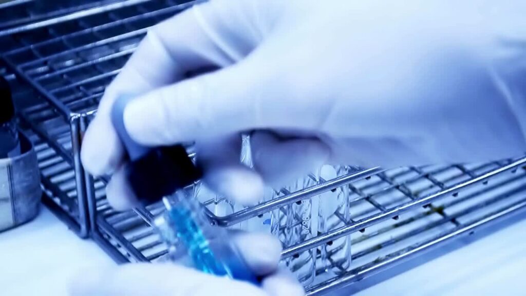 Besoin d’un bilan de santé ? Voici pourquoi il ne faut pas attendre