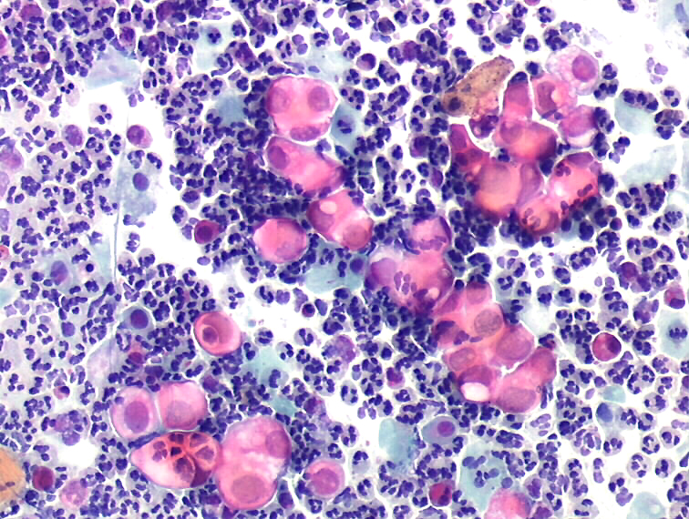 Analyse anatomo-cytopathologique au Laboratoire Bionov